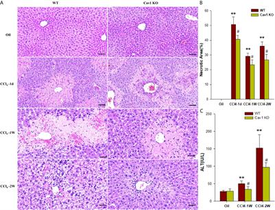 Caveolin-1 Deficiency Protects Mice Against Carbon Tetrachloride-Induced Acute Liver Injury Through Regulating Polarization of Hepatic Macrophages